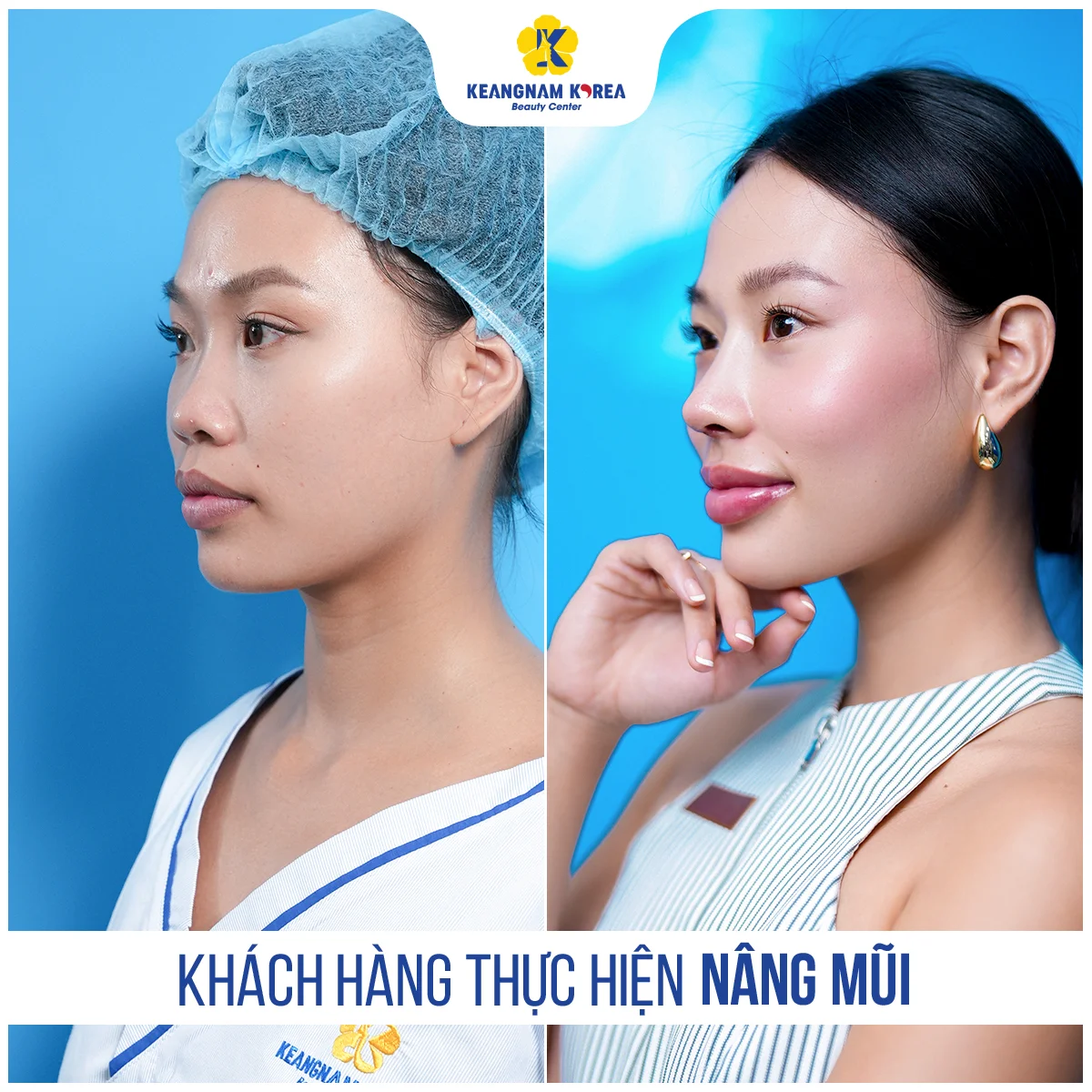 1200x1200_RBC_Nang-mui1