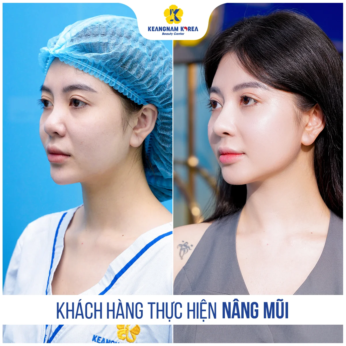 1200x1200_RBC_Nang-mui2