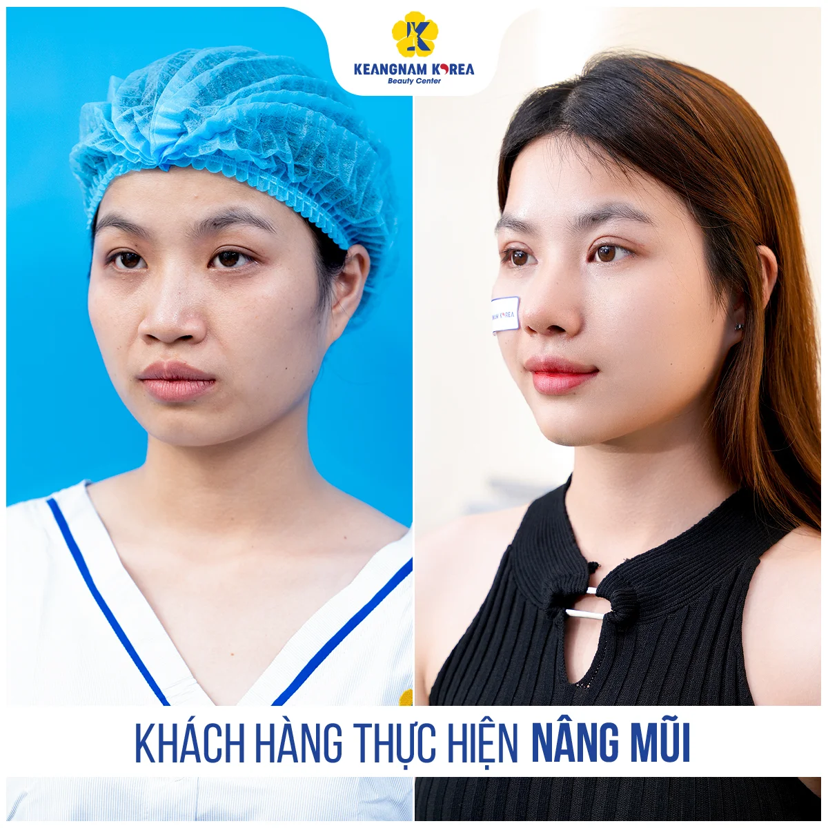 1200x1200_RBC_Nang-mui6