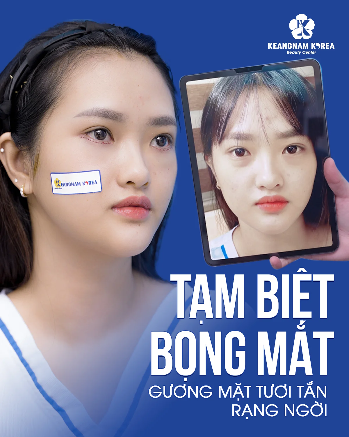 1200x1500 Web CM Bong mat