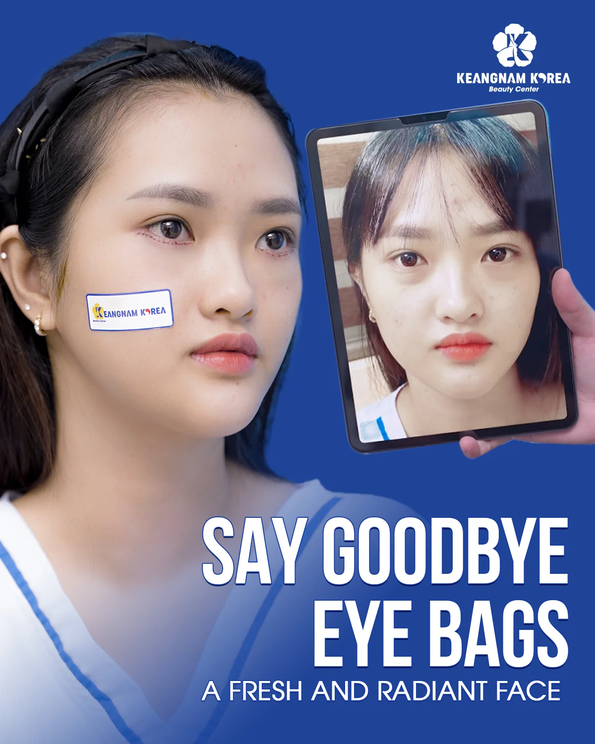 1200x1500 Web CM Bong mat eng