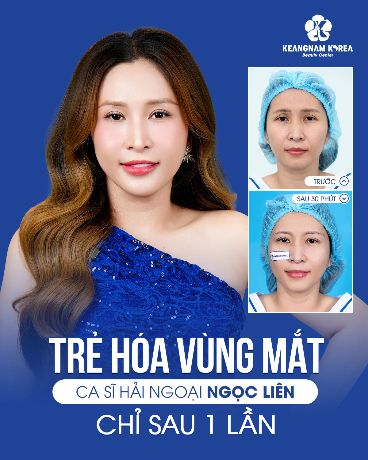 1200x1500 Web CM Cs Ngoc Lien
