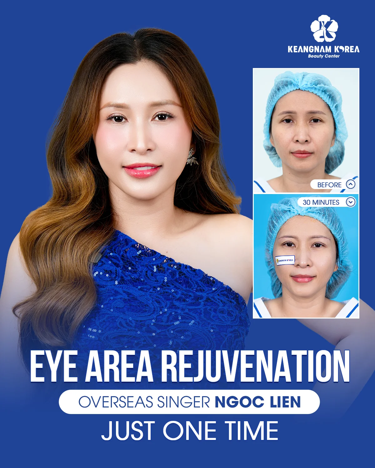 1200x1500 Web CM Cs Ngoc Lien eng