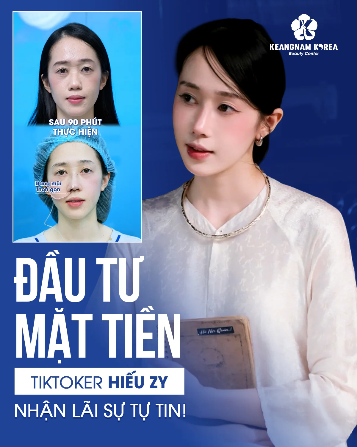 Khách hàng trải nghiệm nâng mũi