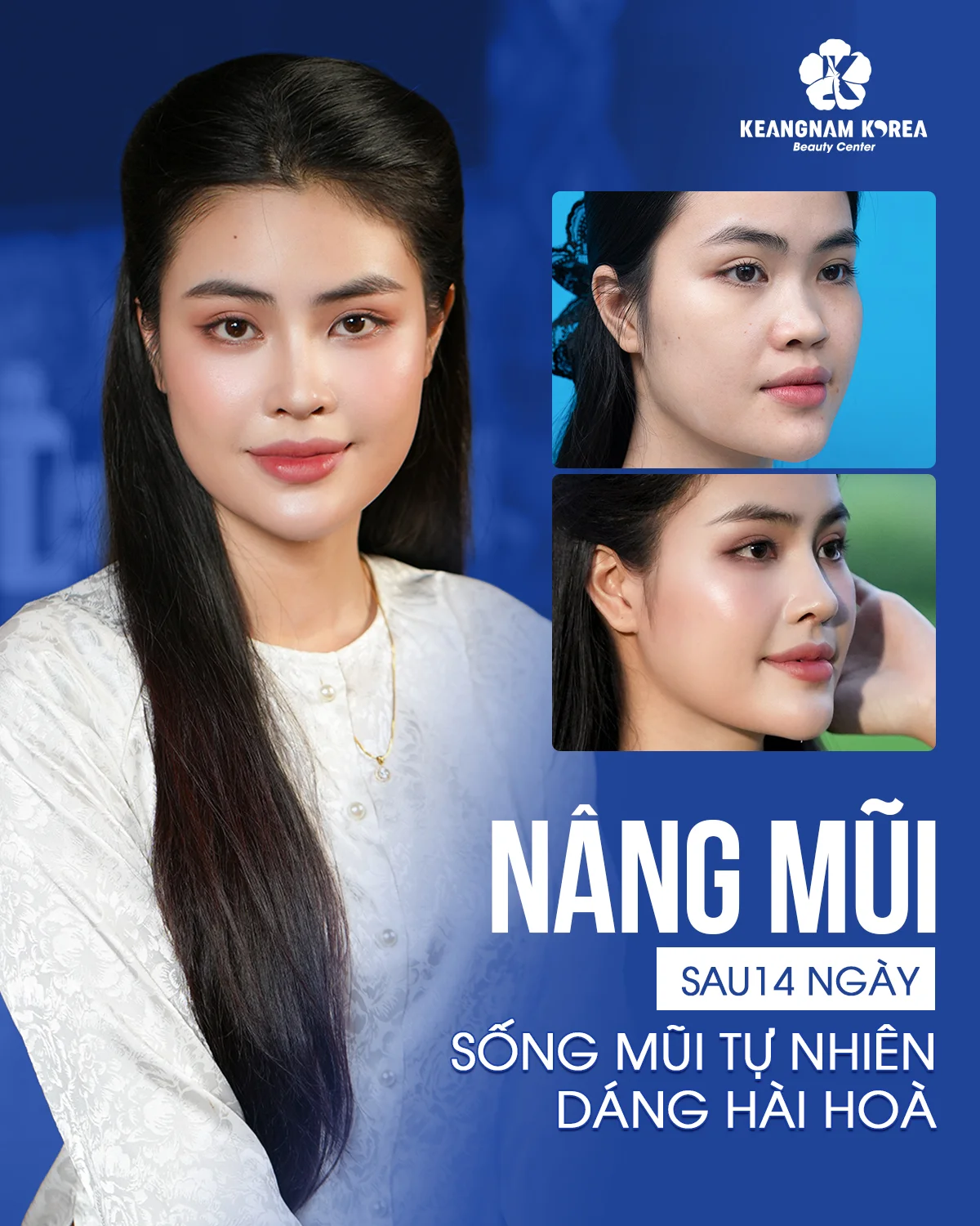 1200x1500 Web NM Truc Linh