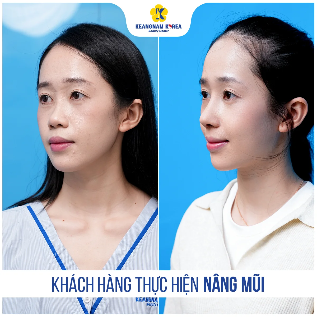 BF AF NANG MUI Hieu Vy