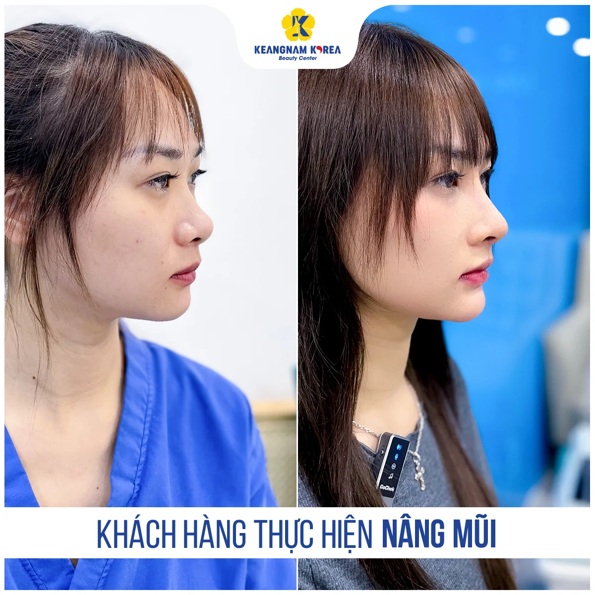 BF AF NANG MUI Sang