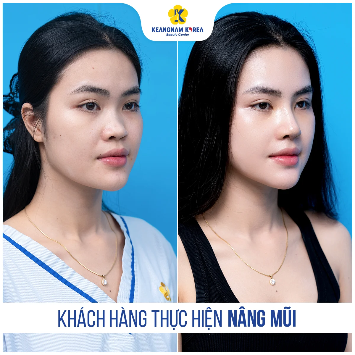 BF AF NANG MUI Truc Linh