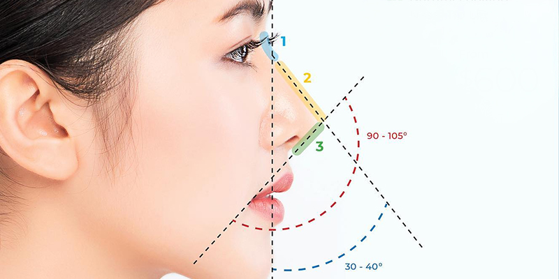 Nâng mũi gồm những phương pháp nào? Giá bao nhiêu? Bao lâu thì đẹp? Có nguy hiểm không? Các kinh nghiệm và rủi ro thường gặp 1 Nâng mũi gồm những phương pháp nào