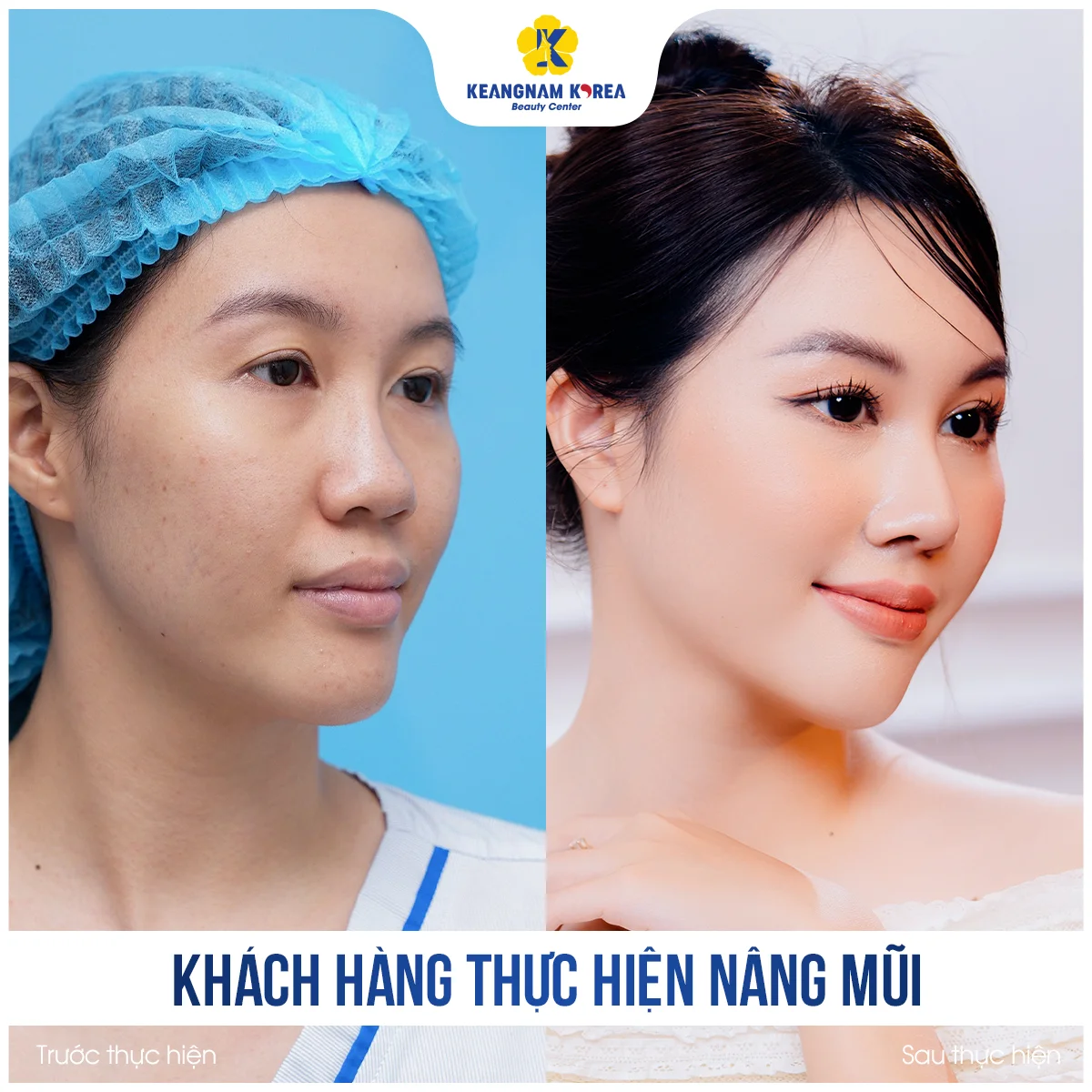 NM Andrea Minh Thu