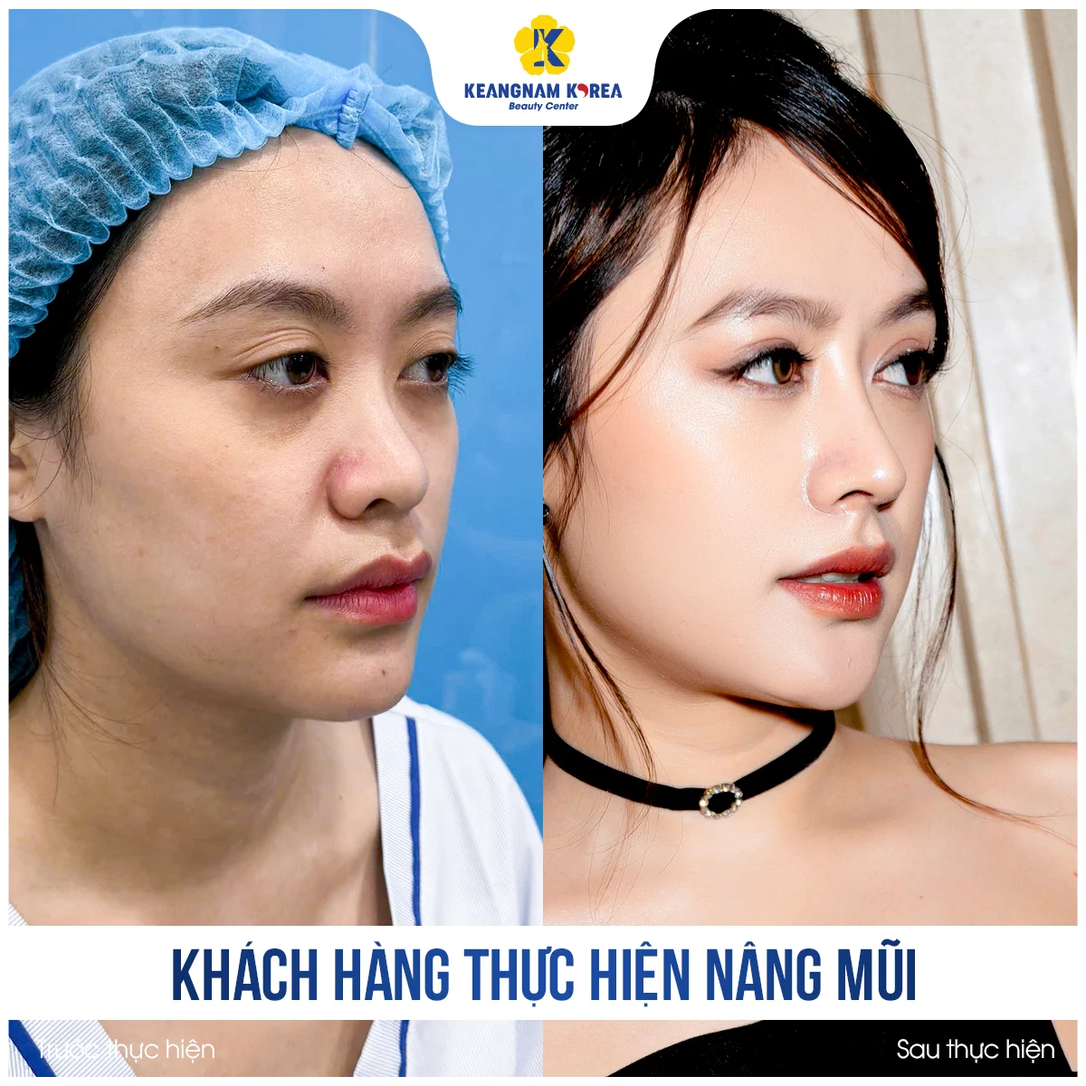 NM Trinh