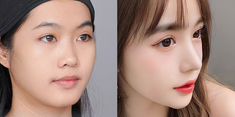 Mũi cao là như thế nào? Cách nhận biết, ý nghĩa thẩm mỹ và nhân tướng học ở nam và nữ 2 so sánh mũi cao và mũi tẹt