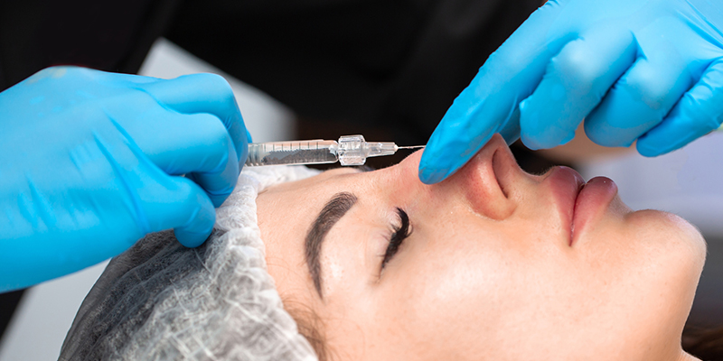 Các phương pháp nâng mũi không phẫu thuật tốt nhất 2026 2 Nâng mũi bằng filler