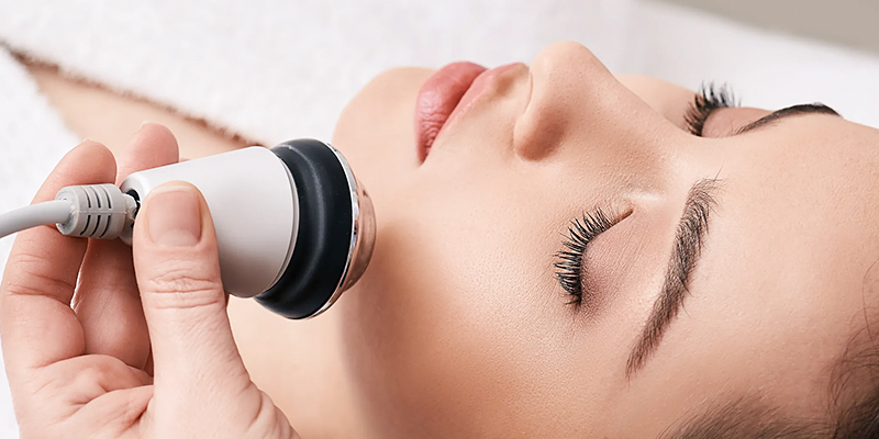 Review top 5 công nghệ nâng cơ mặt trẻ hóa hàng đầu 2026: Ultherapy, HIFU, RF, Softwave hay tiêm? 2 Sóng RF nâng cơ