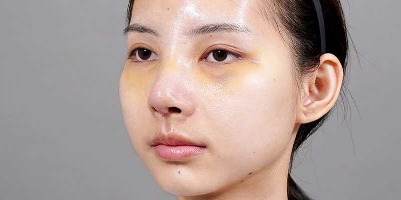 Những hiện tượng sau khi nâng mũi là gì? Đâu là dấu hiệu bình thường và bất thường cần tuyệt đối lưu tâm? 3 Những hiện tượng bình thường sau khi nâng mũi