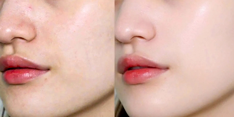 Review Các Hoạt Chất Dưỡng Sáng Da Đỉnh Cao: Vitamin C, AHA và Niacinamide 2 Review Các Hoạt Chất Dưỡng Sáng da