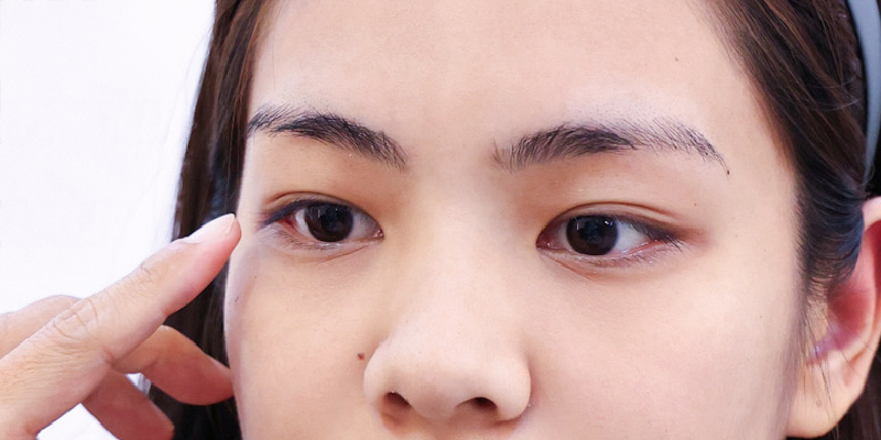 Lấy mỡ mí mắt trên bao nhiêu tiền? Nên cắt mỡ mắt trên ở đâu? 2 lấy mỡ mí mắt trên bao nhiêu tiền