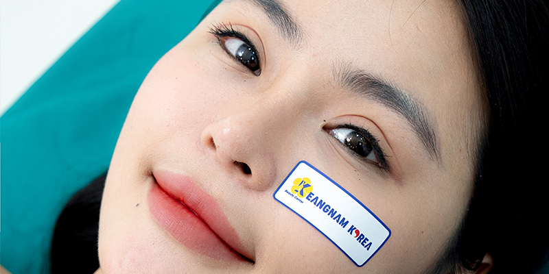 Mở góc mắt ngoài có tác dụng gì? So sánh và hình ảnh thực tế khi mở góc mắt trong và ngoài 4 Hình ảnh mở góc mắt ngoài