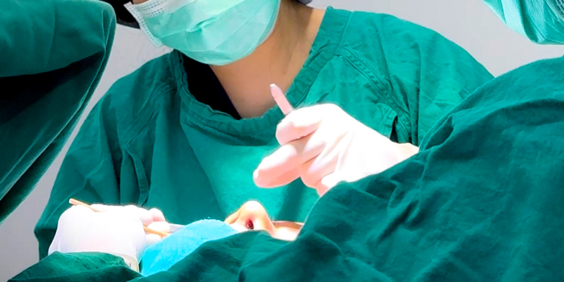 Mũi gồ là gì? Trong tướng số có tốt không? Đâu là cách khắc phục mũi gồ phổ biến nhất 3 cách khắc phục mũi gồ