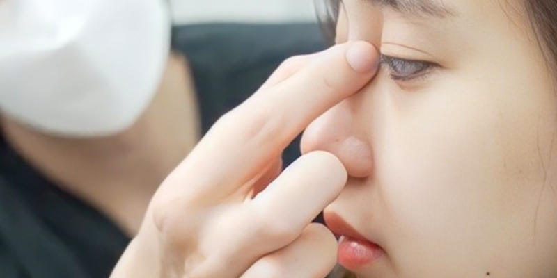 Nâng mũi bán cấu trúc là gì? Giá bao nhiêu? Có vĩnh viễn không? Ưu nhược điểm so với nâng mũi cấu trúc 4 nâng mũi bán cấu trúc có vĩnh viễn không