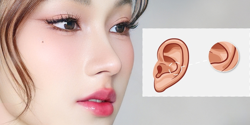 Nâng mũi bằng sụn tai có tốt không? Có đau không? Giữ được bao lâu? 1 nâng mũi bằng sụn tai có tốt không