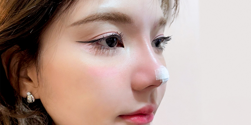 Sống mũi cao, thẳng có ý nghĩa gì trong thẩm mỹ? Đâu là các phương pháp nâng mũi phù hợp để có sống mũi cao? 3 Sống mũi cao, thẳng có ý nghĩa gì trong thẩm mỹ khuôn mặt?