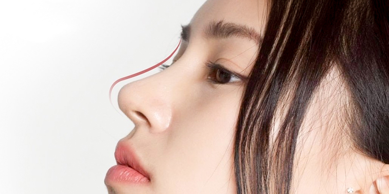 Nâng mũi Pureform là gì? Giá bao nhiêu 1 Nâng mũi Pureform là gì