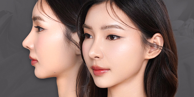 Mũi cao là như thế nào? Cách nhận biết, ý nghĩa thẩm mỹ và nhân tướng học ở nam và nữ 3 mũi nữ cao đẹp