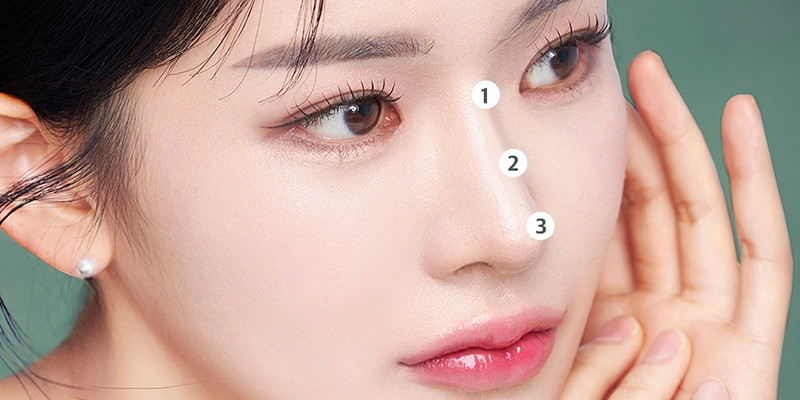 semi structural rhinoplasty