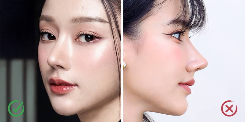 Sống mũi cao, thẳng có ý nghĩa gì trong thẩm mỹ? Đâu là các phương pháp nâng mũi phù hợp để có sống mũi cao? 2 Sống mũi cao, thẳng có ý nghĩa gì trong thẩm mỹ khuôn mặt?