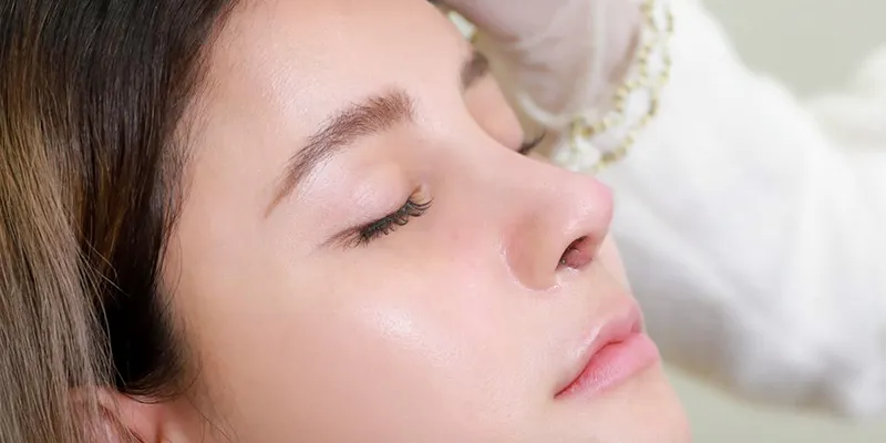 Nâng mũi 1 tháng đầu mũi bị đỏ, nguyên nhân là gì? Làm sao để khắc phục? 1 Nâng mũi 1 tháng đầu mũi bị đỏ