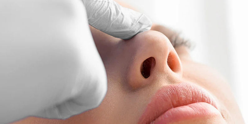 Bọc cân cơ đầu mũi là gì? Ưu nhược điểm nên biết trước khi thực hiện 1 Bọc cân cơ đầu mũi