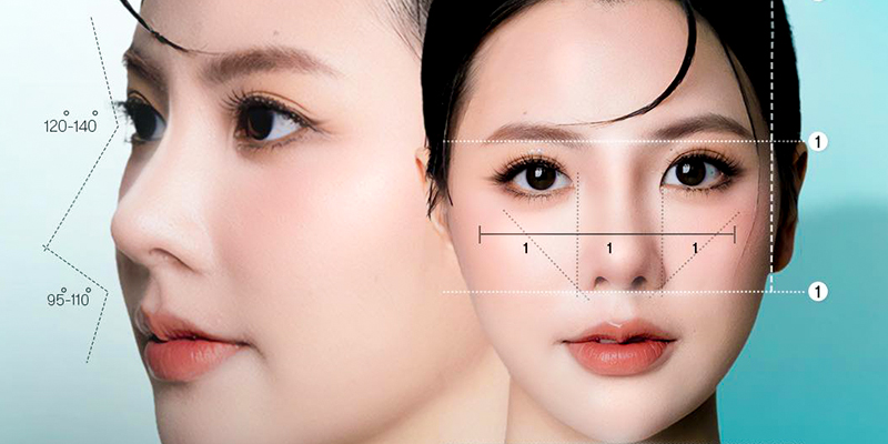 Mũi hếch là gì? Đâu là cách khắc phục mũi hếch an toàn, hiệu quả nhanh? 2 cách khắc phục mũi hếch