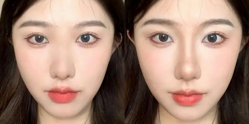 Điểm tên các cách làm mũi thon và cao tại nhà cùng những lưu ý để tránh làm mũi to ra 3 cách làm mũi thon và cao