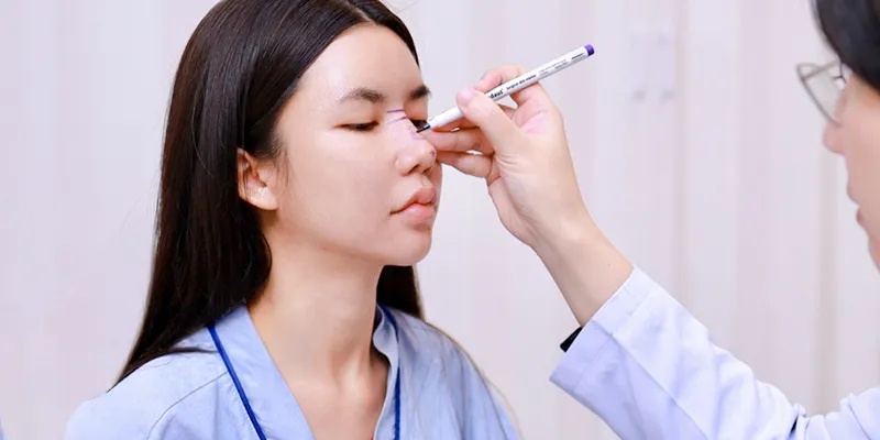 Phân biệt cuộn cánh mũi và cắt cánh mũi: Phương pháp nào phù hợp với bạn? 4 Nên cuộn cánh mũi hay cắt cánh mũi