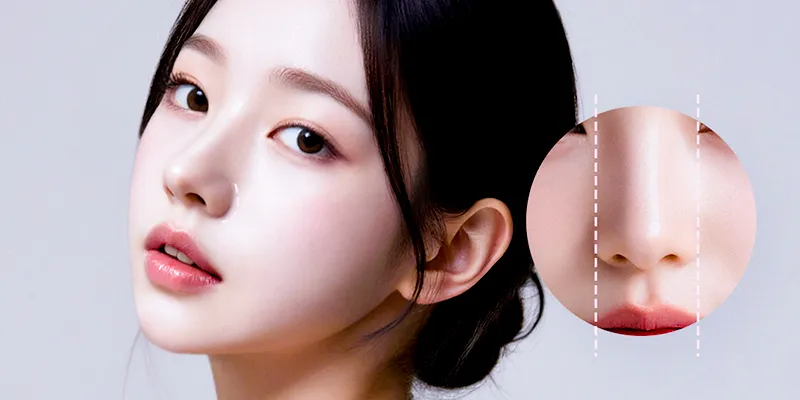 Thu gọn đầu mũi giá bao nhiêu? Bao lâu hết sưng? Có vĩnh viễn không? Các combo kết hợp để đạt dáng mũi như mong đợi 1 Thu gọn đầu mũi giá bao nhiêu