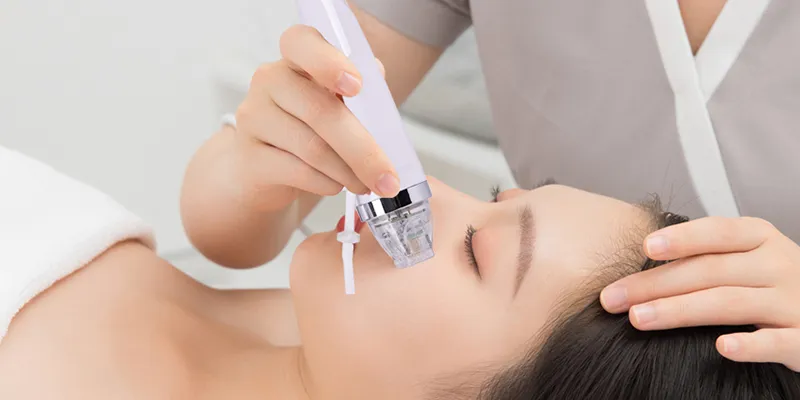 Đâu là cách thu nhỏ cánh mũi không phẫu thuật hiệu quả thực tế? 3 cách thu nhỏ cánh mũi không phẫu thuật bằng RF