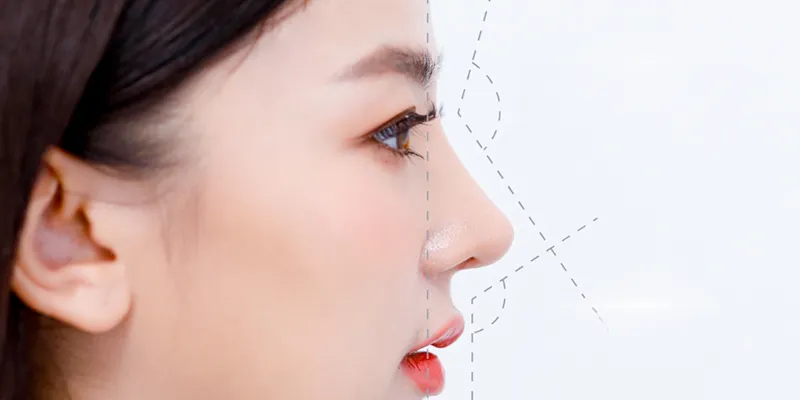 Thu gọn cánh mũi có phá tướng không? Đâu là những tướng mũi nên thực hiện để chiêu tài lộc 2 tỷ lệ vàng của mũi trong nhân tướng học