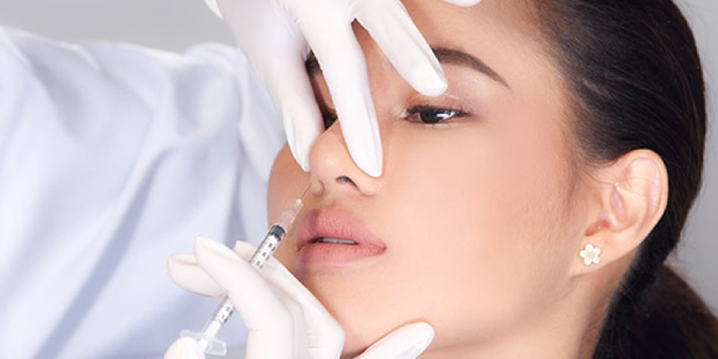 Tiêm gọn cánh mũi có những phương pháp nào? 5 tiêm gọn cánh mũi