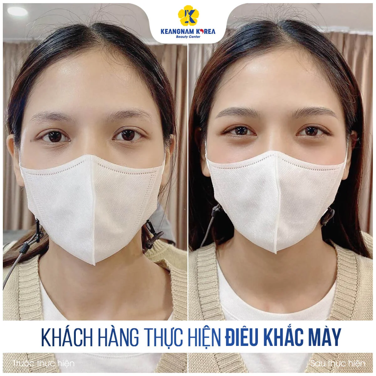 Điêu Khắc Chân Mày 8 BF_AF_dieu-khach-chan-may-1-1