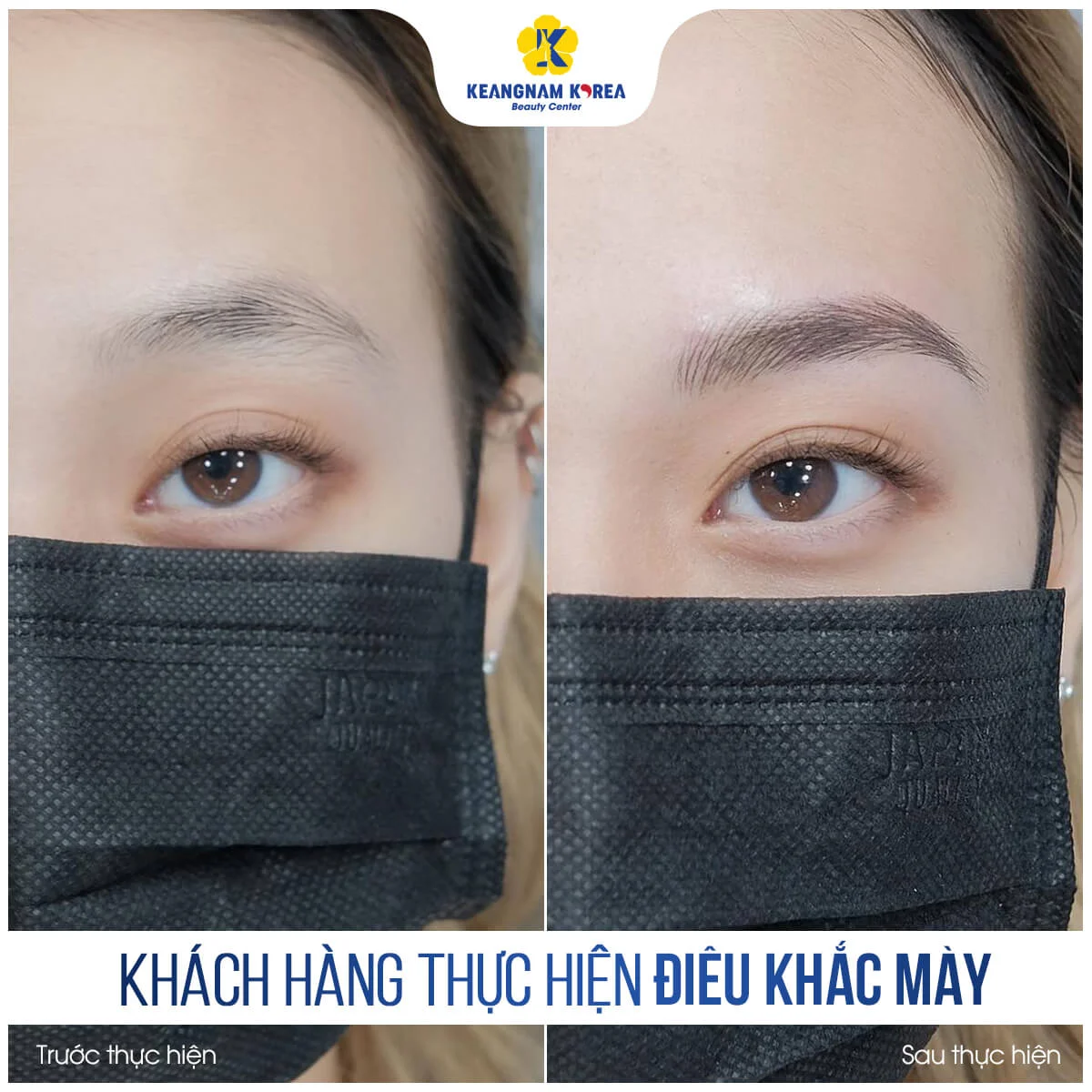 Điêu Khắc Chân Mày 7 BF_AF_dieu-khach-chan-may-2-1