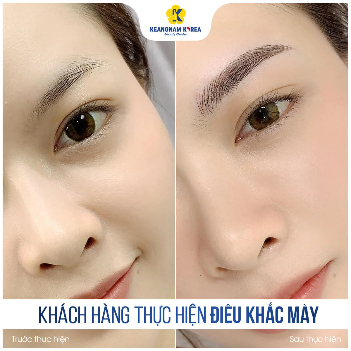 Điêu Khắc Chân Mày 6 BF_AF_dieu-khach-chan-may-3-1