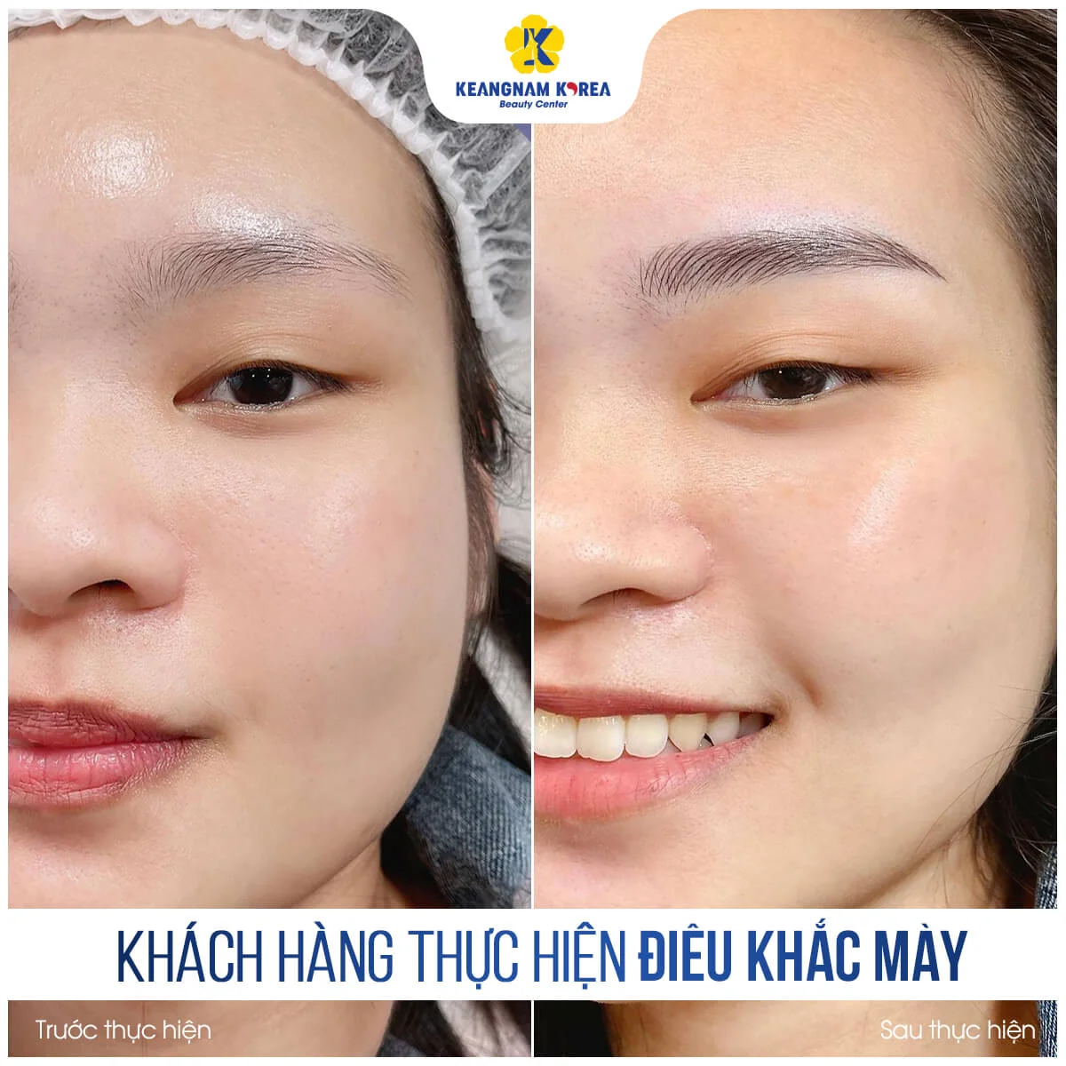 Điêu Khắc Chân Mày 5 BF_AF_dieu-khach-chan-may-4-1