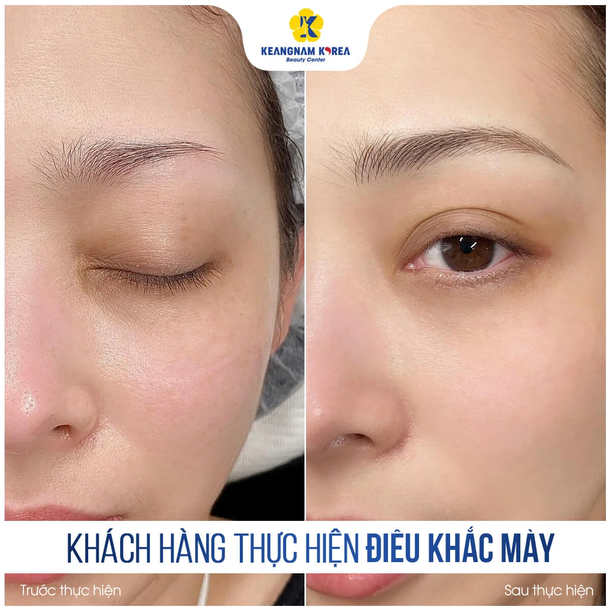 Điêu Khắc Chân Mày 4 BF_AF_dieu-khach-chan-may-5-1