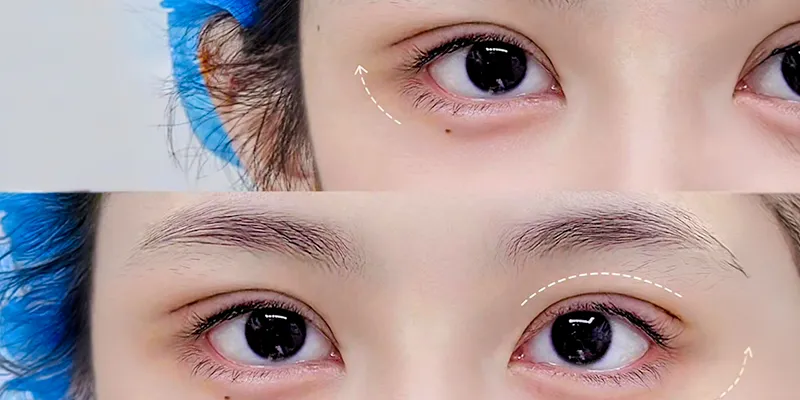 Hạ lệ mắt là gì? Giải pháp biến mắt xếch thành mắt to tròn, dịu dàng chuẩn Châu Á 6 Hạ lệ mắt là gì