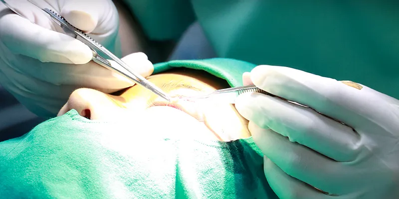 Hạ lệ mắt là gì? Giải pháp biến mắt xếch thành mắt to tròn, dịu dàng chuẩn Châu Á 7 Hạ lệ mắt là gì
