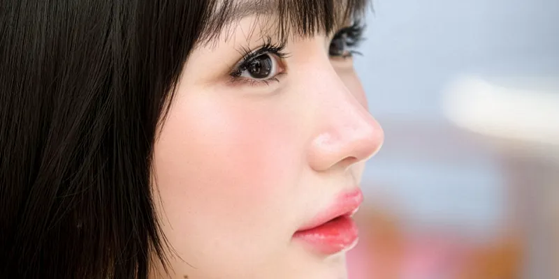 Căng chỉ mũi có an toàn không? Những điều cần biết trước khi quyết định 1 căng chỉ mũi có an toàn không