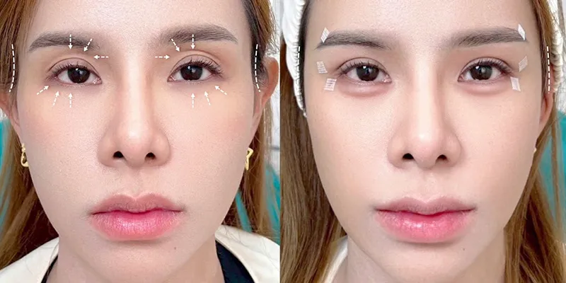Hốc mắt sâu trong tướng số nói lên điều gì ở nam và nữ? Cát hay hung? Cách hóa giải để đổi vận 4 Hốc mắt sâu trong tướng số có ý nghĩa gì