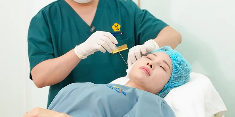 Làm đầy má hóp vĩnh viễn được không? Gồm những cách nào? 4 làm đầy má hóp vĩnh viễn