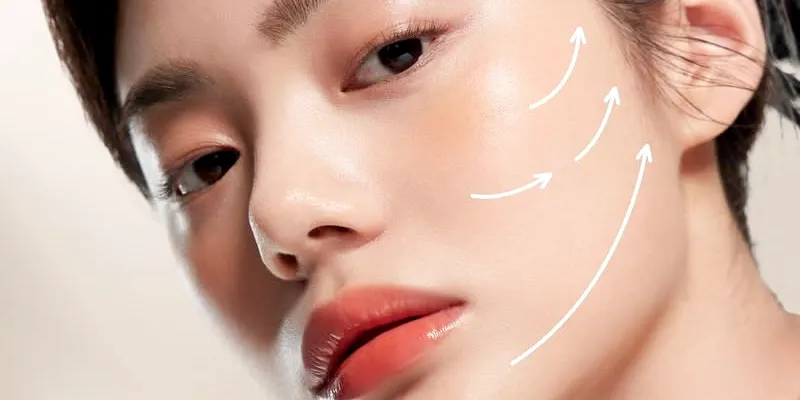 Làm đầy má hóp vĩnh viễn được không? Gồm những cách nào? 1 làm đầy má hóp vĩnh viễn